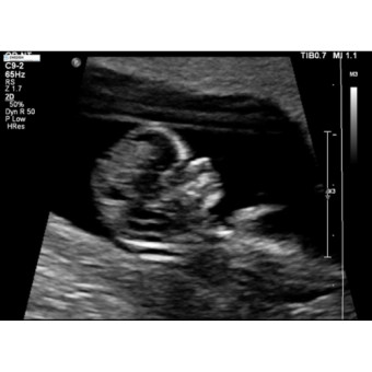 Babylist Registry Photo.