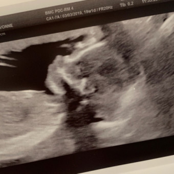 Babylist Registry Photo.