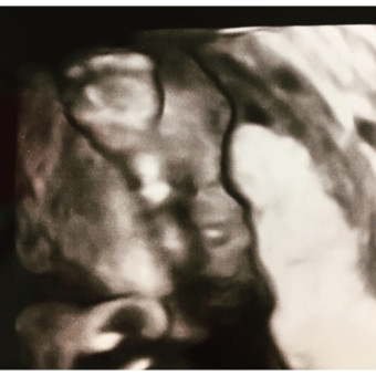 Babylist Registry Photo.