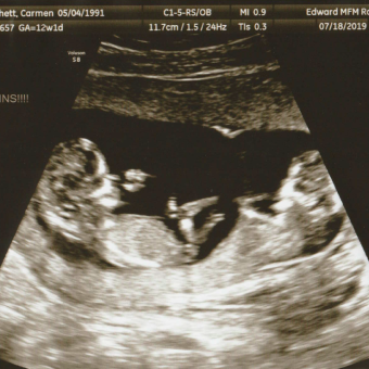 Babylist Registry Photo.