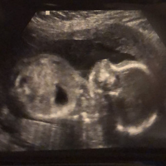Babylist Registry Photo.