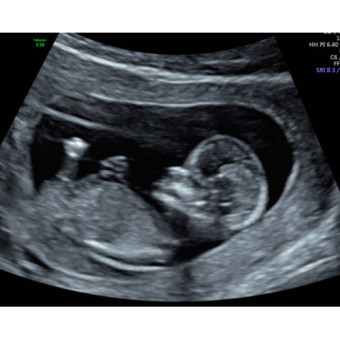 Babylist Registry Photo.