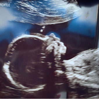 Babylist Registry Photo.
