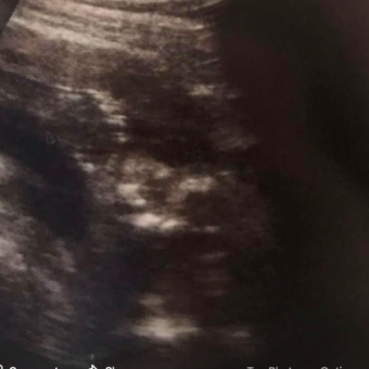 Babylist Registry Photo.