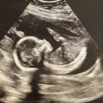 Babylist Registry Photo.