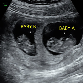 Babylist Registry Photo.