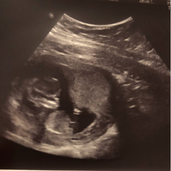 Babylist Registry Photo.
