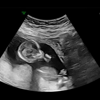 Babylist Registry Photo.