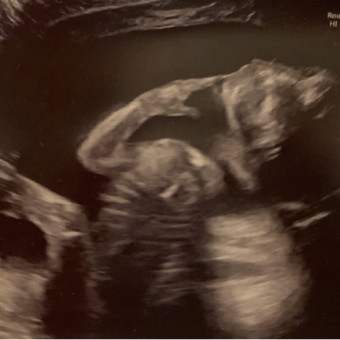 Babylist Registry Photo.