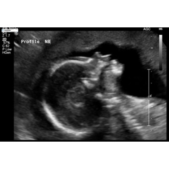 Babylist Registry Photo.