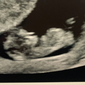 Babylist Registry Photo.