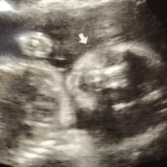 Babylist Registry Photo.