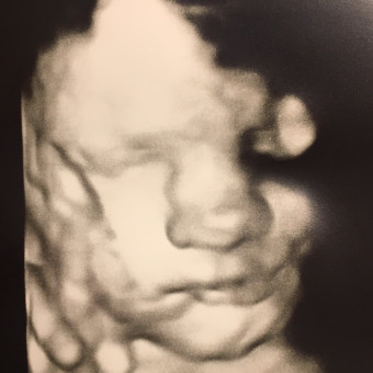Babylist Registry Photo.