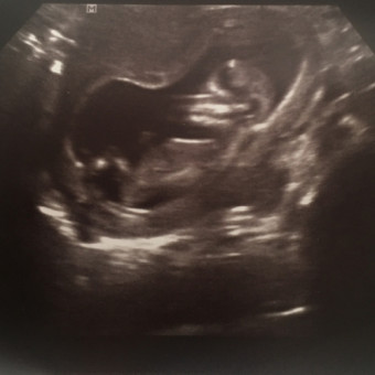 Babylist Registry Photo.