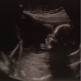 Babylist Registry Photo.