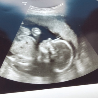 Babylist Registry Photo.