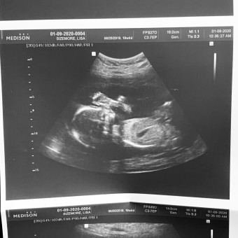 Babylist Registry Photo.