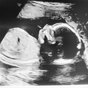 Babylist Registry Photo.