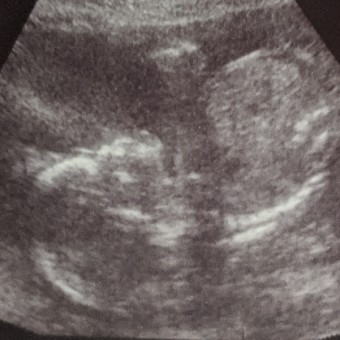 Babylist Registry Photo.