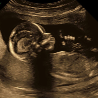 Babylist Registry Photo.