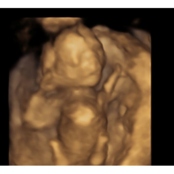 Babylist Registry Photo.