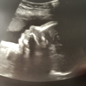 Babylist Registry Photo.