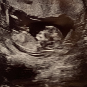 Babylist Registry Photo.