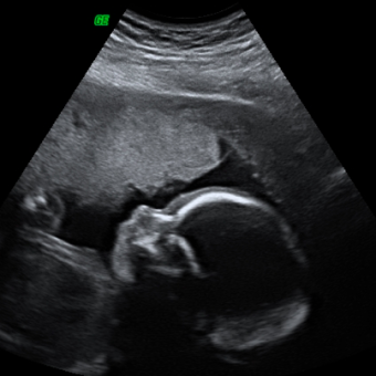 Babylist Registry Photo.