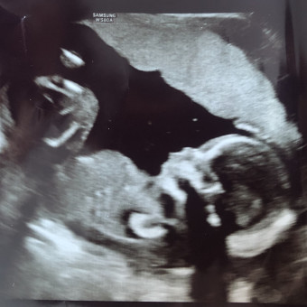 Babylist Registry Photo.