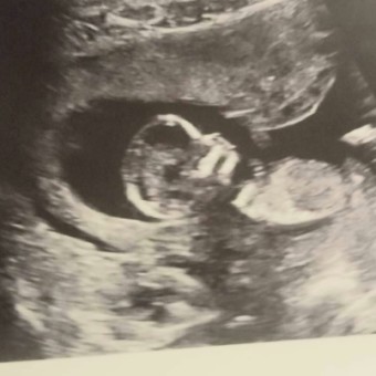 Babylist Registry Photo.