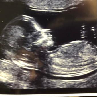 Babylist Registry Photo.