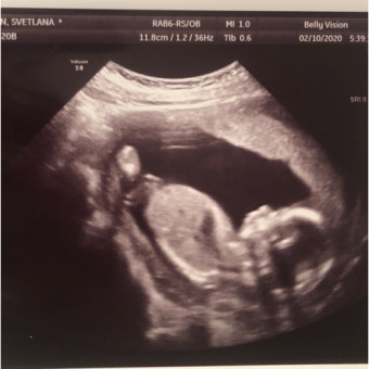Babylist Registry Photo.