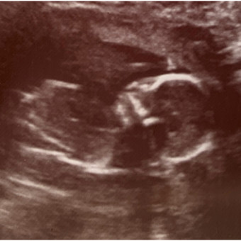 Babylist Registry Photo.