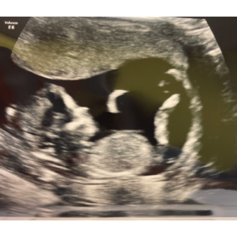 Babylist Registry Photo.