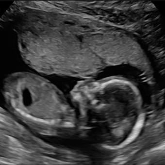 Babylist Registry Photo.