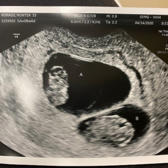 Babylist Registry Photo.