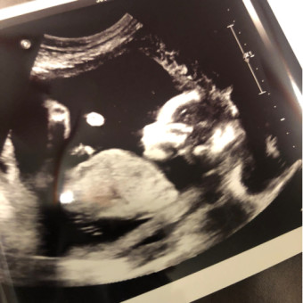 Babylist Registry Photo.