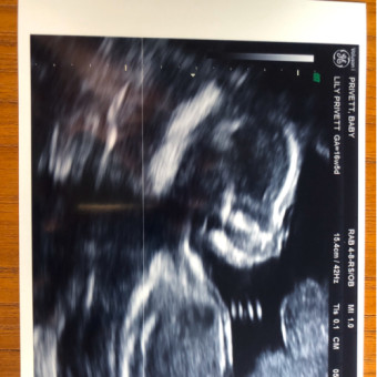 Babylist Registry Photo.