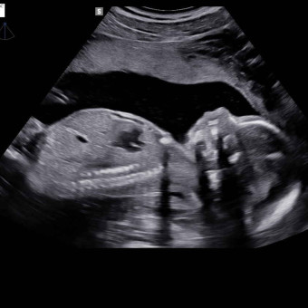 Babylist Registry Photo.