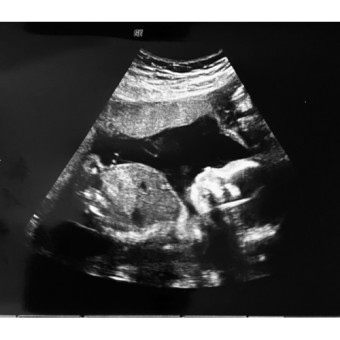 Babylist Registry Photo.