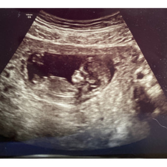 Babylist Registry Photo.