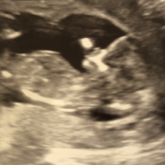 Babylist Registry Photo.