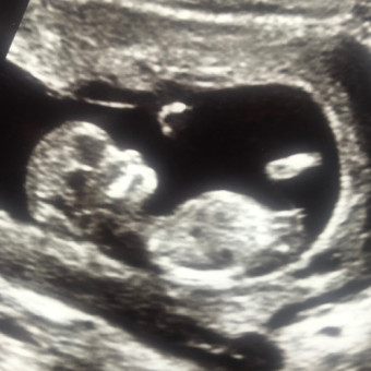 Babylist Registry Photo.