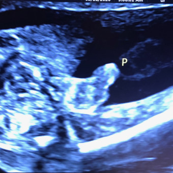 Babylist Registry Photo.