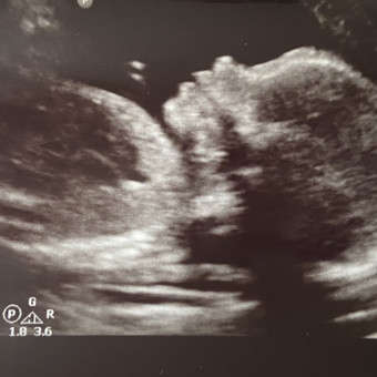 Babylist Registry Photo.