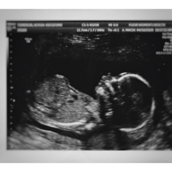 Babylist Registry Photo.
