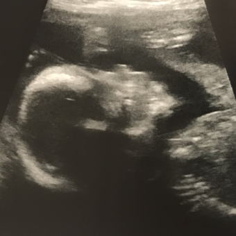 Babylist Registry Photo.