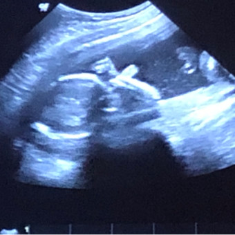 Babylist Registry Photo.