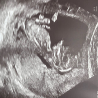 Babylist Registry Photo.
