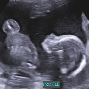 Babylist Registry Photo.